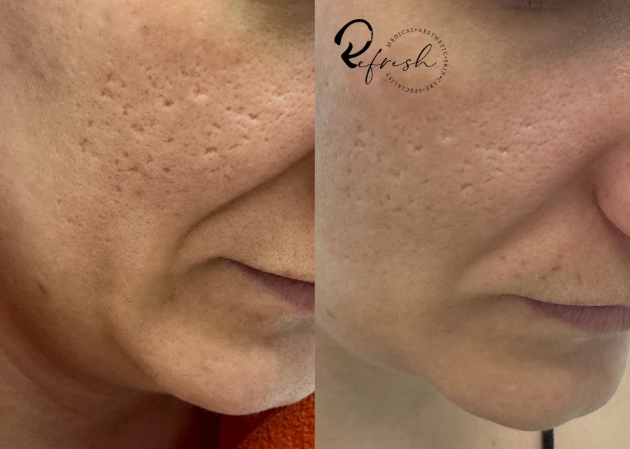 Скин бустер - Reservation.Studio Скин бустер - Reservation.Studio