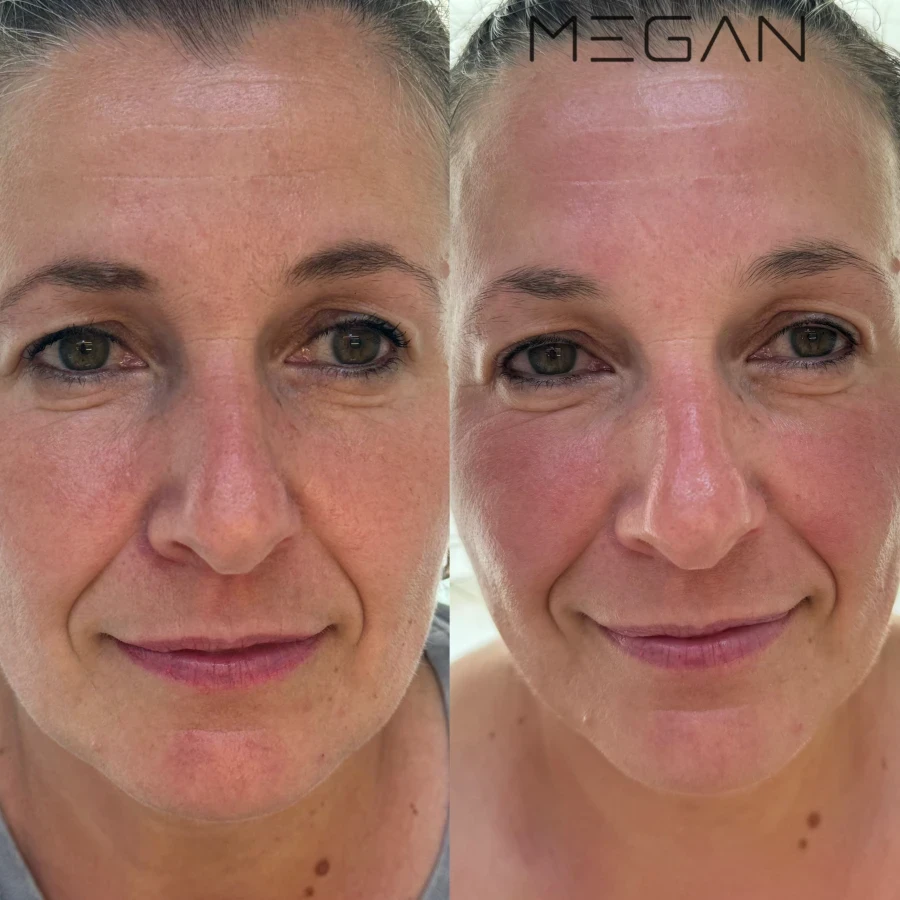 Козметична процедура - Reservation.Studio