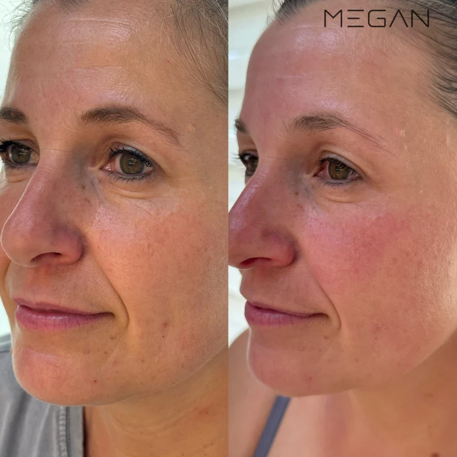 Козметична процедура - Reservation.Studio Козметична процедура - Reservation.Studio