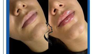 Dr. Serafimov Medical Aesthetics Dr. Serafimov Medical Aesthetics