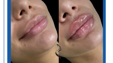 Dr. Serafimov Medical Aesthetics Dr. Serafimov Medical Aesthetics