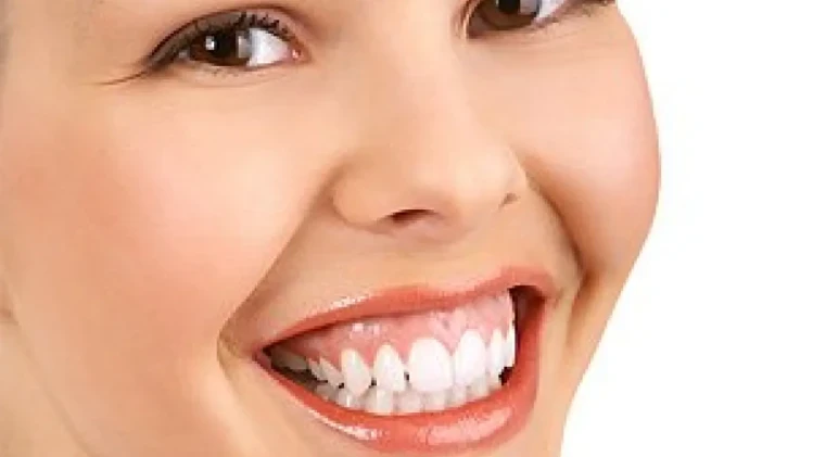 💉 Ботулинов токсин за корекция на венечна усмивка (Gummy smile) 💉 Ботулинов токсин за корекция на венечна усмивка (Gummy smile)