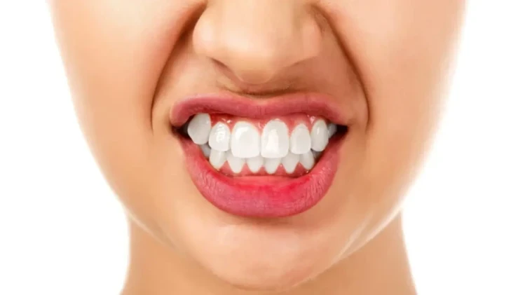 💉 Bruksizm (aşırı diş sıkmasının) tedavisi için botulinum toksini