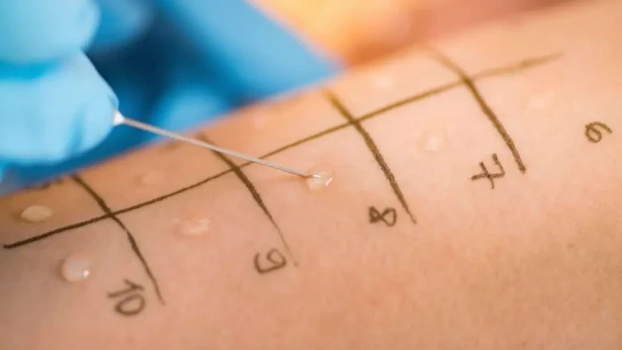 💉 Тестуване за алергия към анестетици