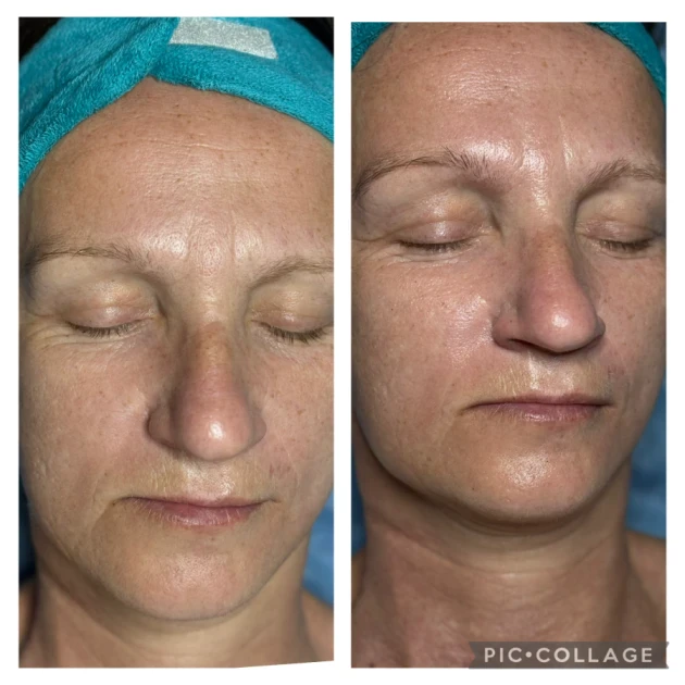 Терапия CSI на Fabbrimarine - Reservation.Studio