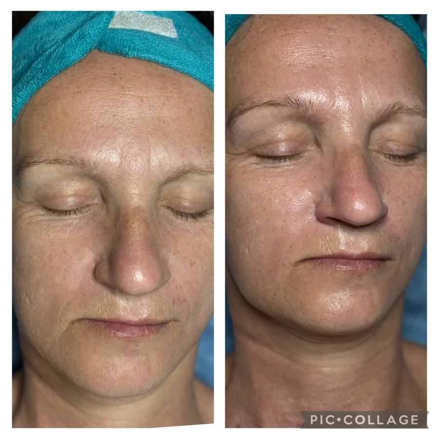 Терапия CSI на Fabbrimarine - Reservation.Studio