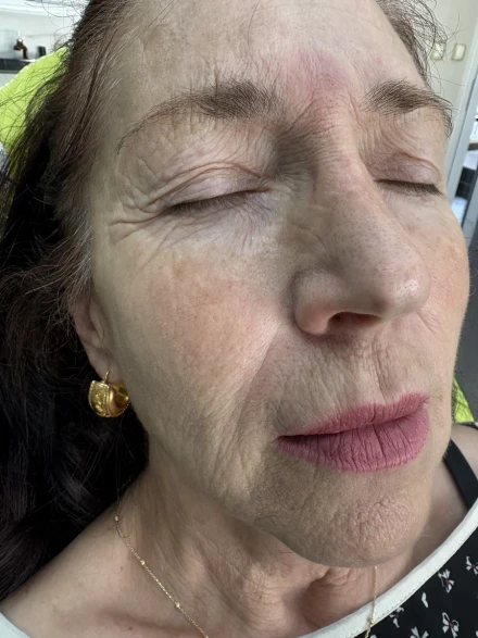 поставяне на филър поставяне на филър