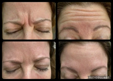 преглед,консултация