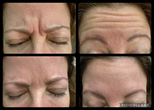 преглед,консултация