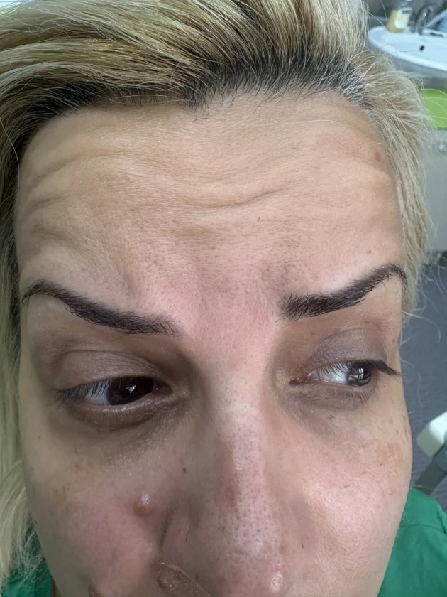 мезотерапия - Reservation.Studio