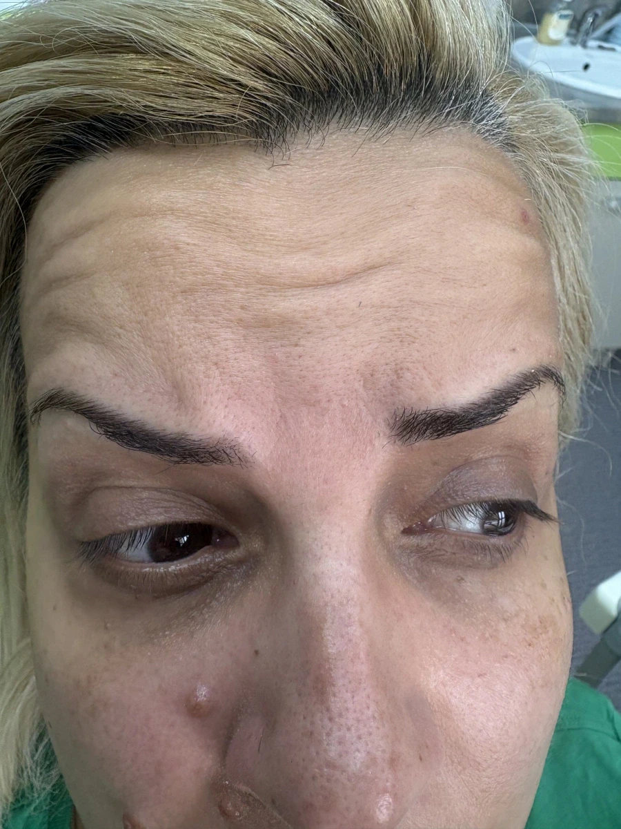 мезотерапия - Reservation.Studio