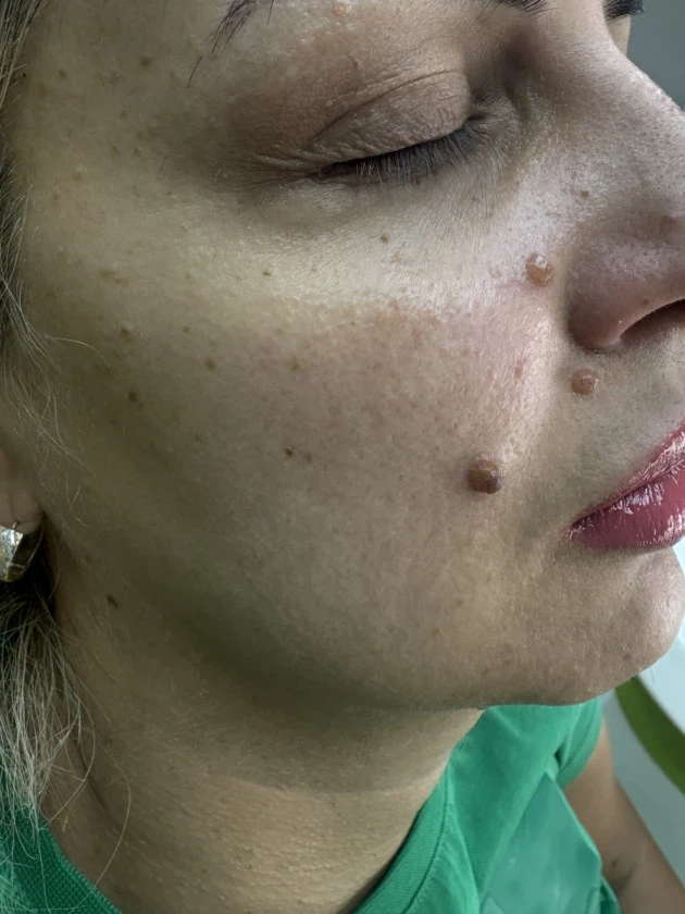 мезотерапия - Reservation.Studio