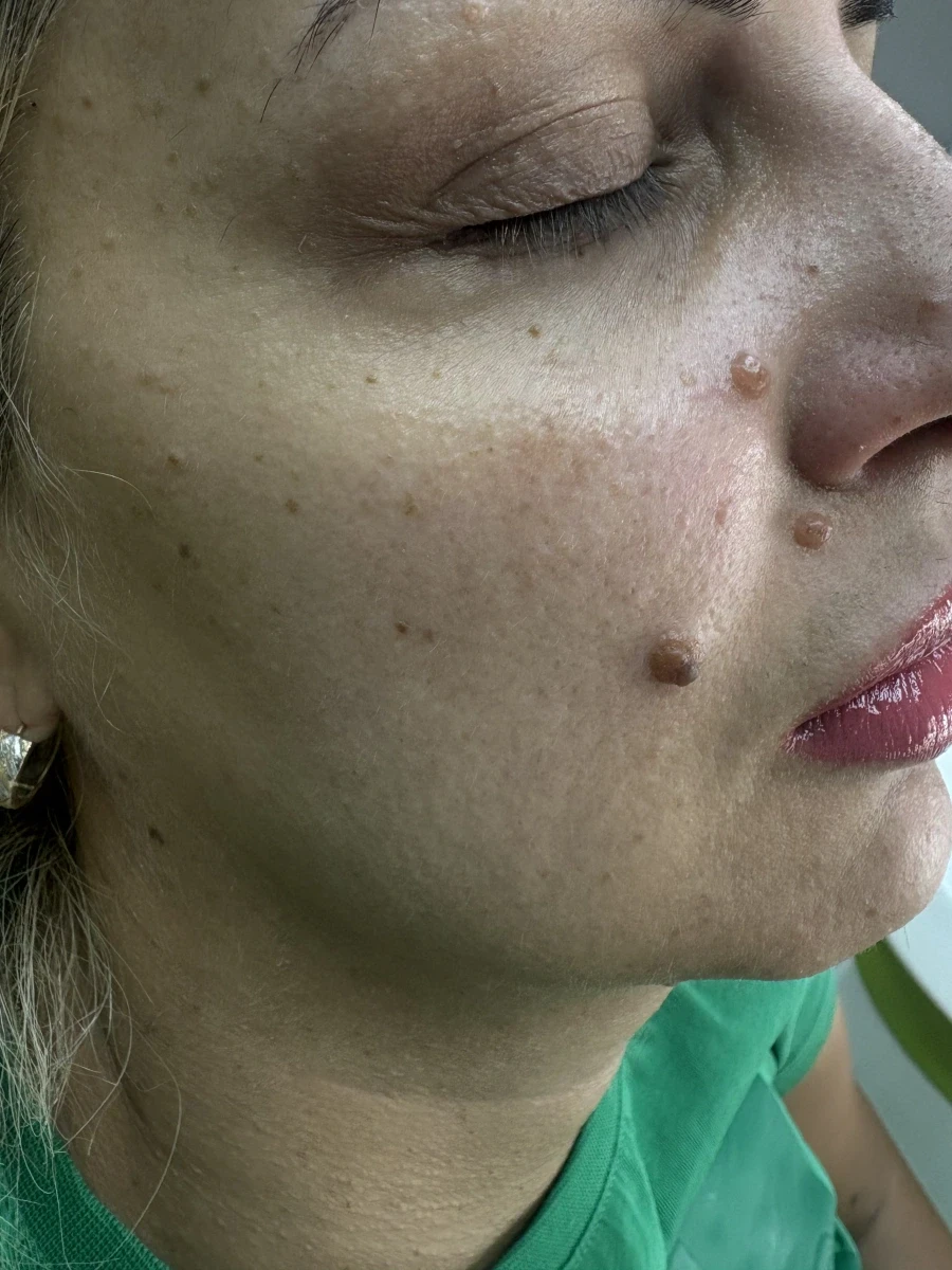 мезотерапия - Reservation.Studio мезотерапия - Reservation.Studio