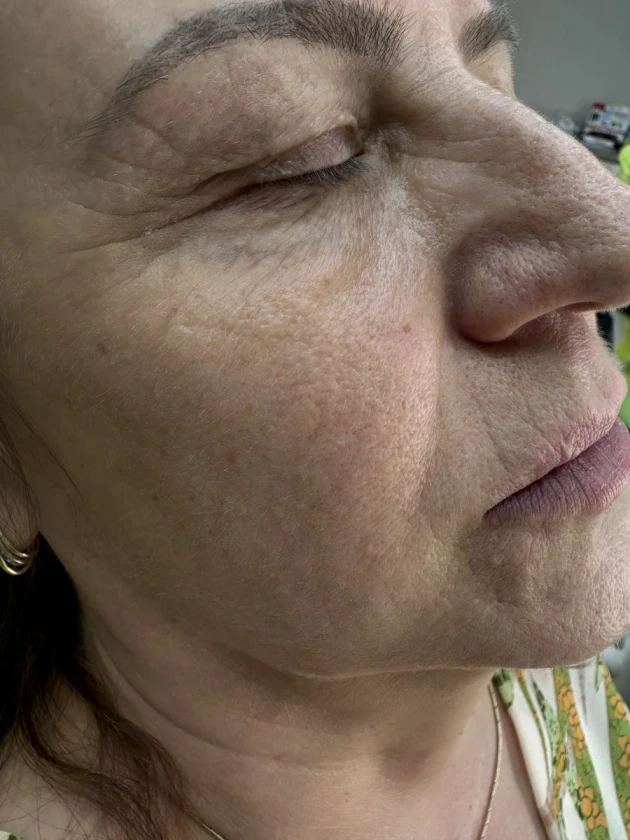 мезотерапия - Reservation.Studio мезотерапия - Reservation.Studio