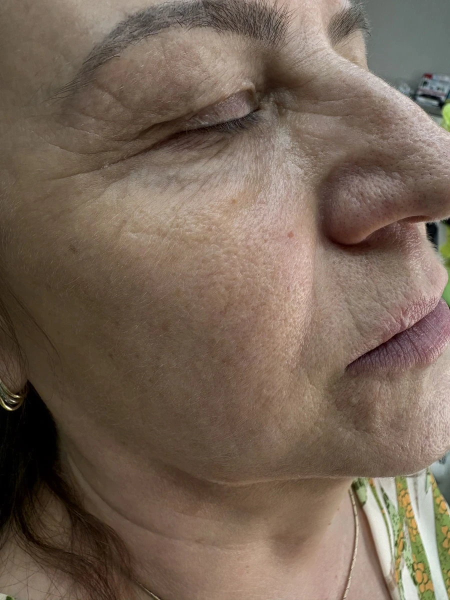 мезотерапия - Reservation.Studio мезотерапия - Reservation.Studio