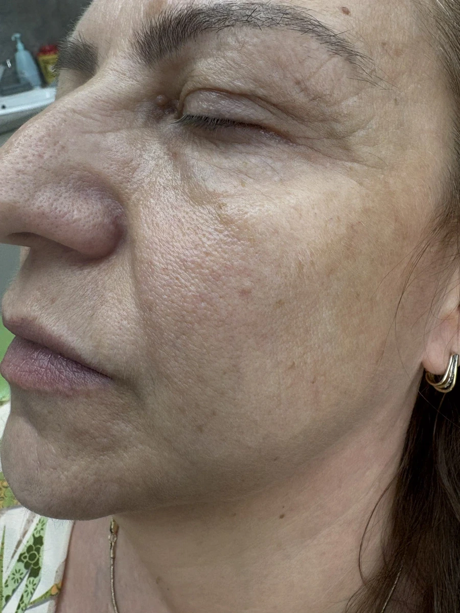 мезотерапия - Reservation.Studio мезотерапия - Reservation.Studio