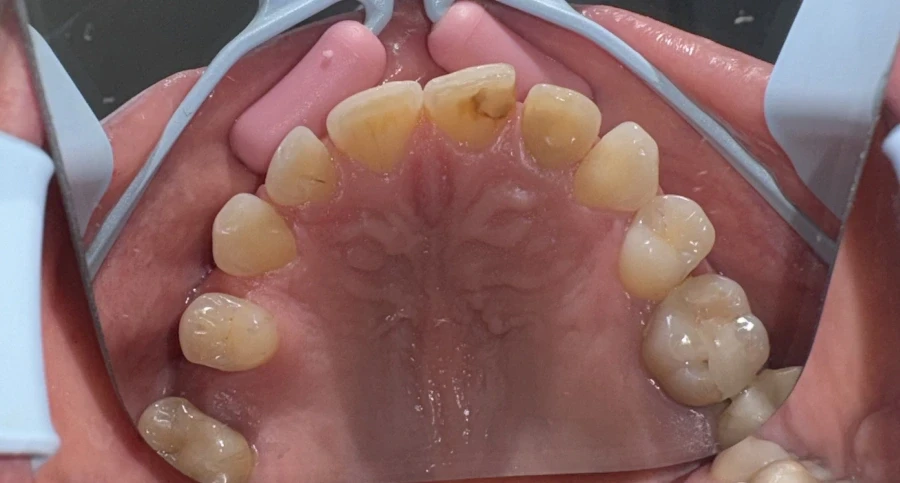 отпечатък за алайнери - Reservation.Studio отпечатък за алайнери - Reservation.Studio