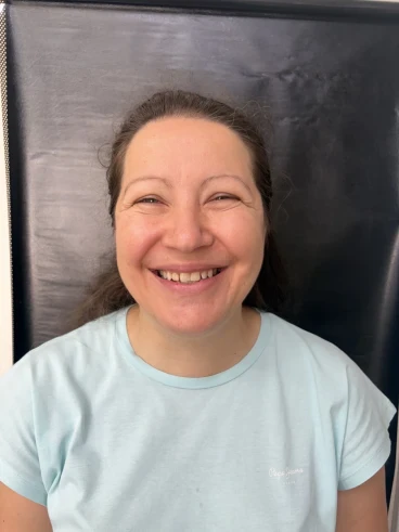 отпечатък за алайнери