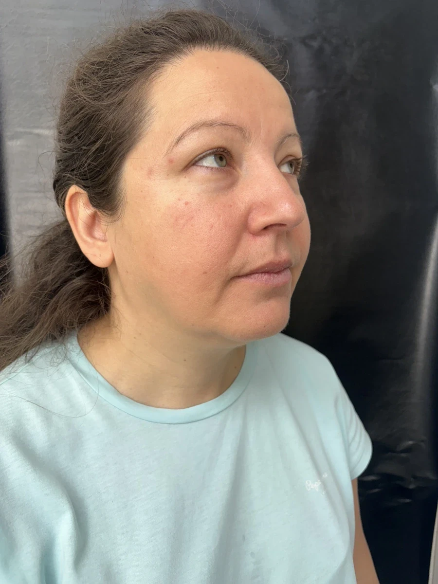 отпечатък за алайнери - Reservation.Studio