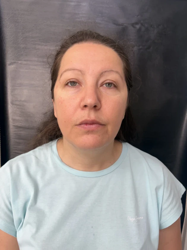 отпечатък за алайнери - Reservation.Studio отпечатък за алайнери - Reservation.Studio