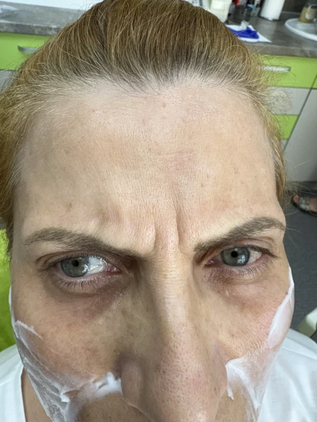 поставяне на ботокс - Reservation.Studio поставяне на ботокс - Reservation.Studio