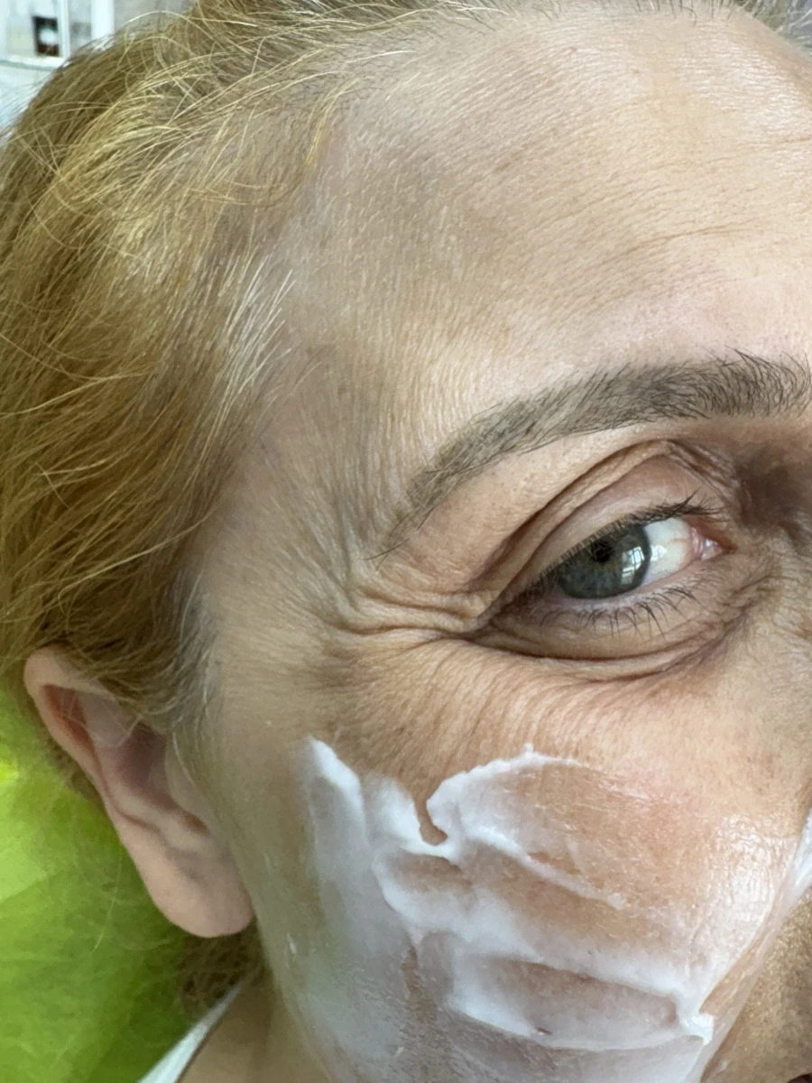 поставяне на ботокс - Reservation.Studio