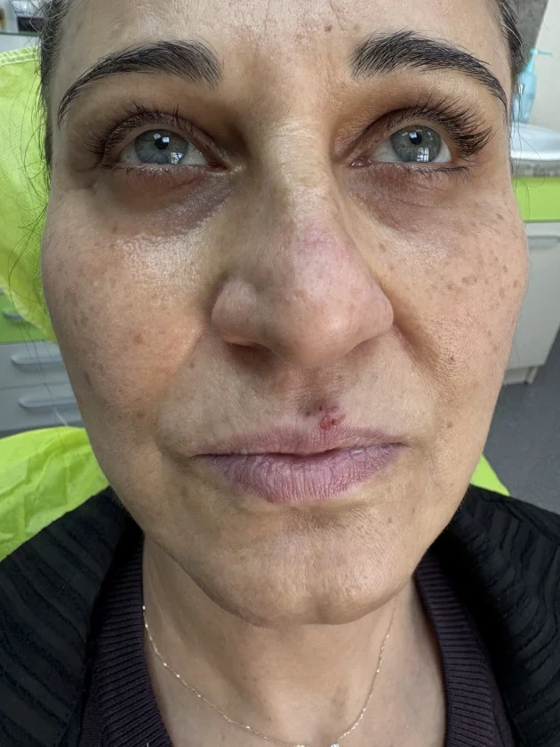 поставяне на филър - Reservation.Studio поставяне на филър - Reservation.Studio