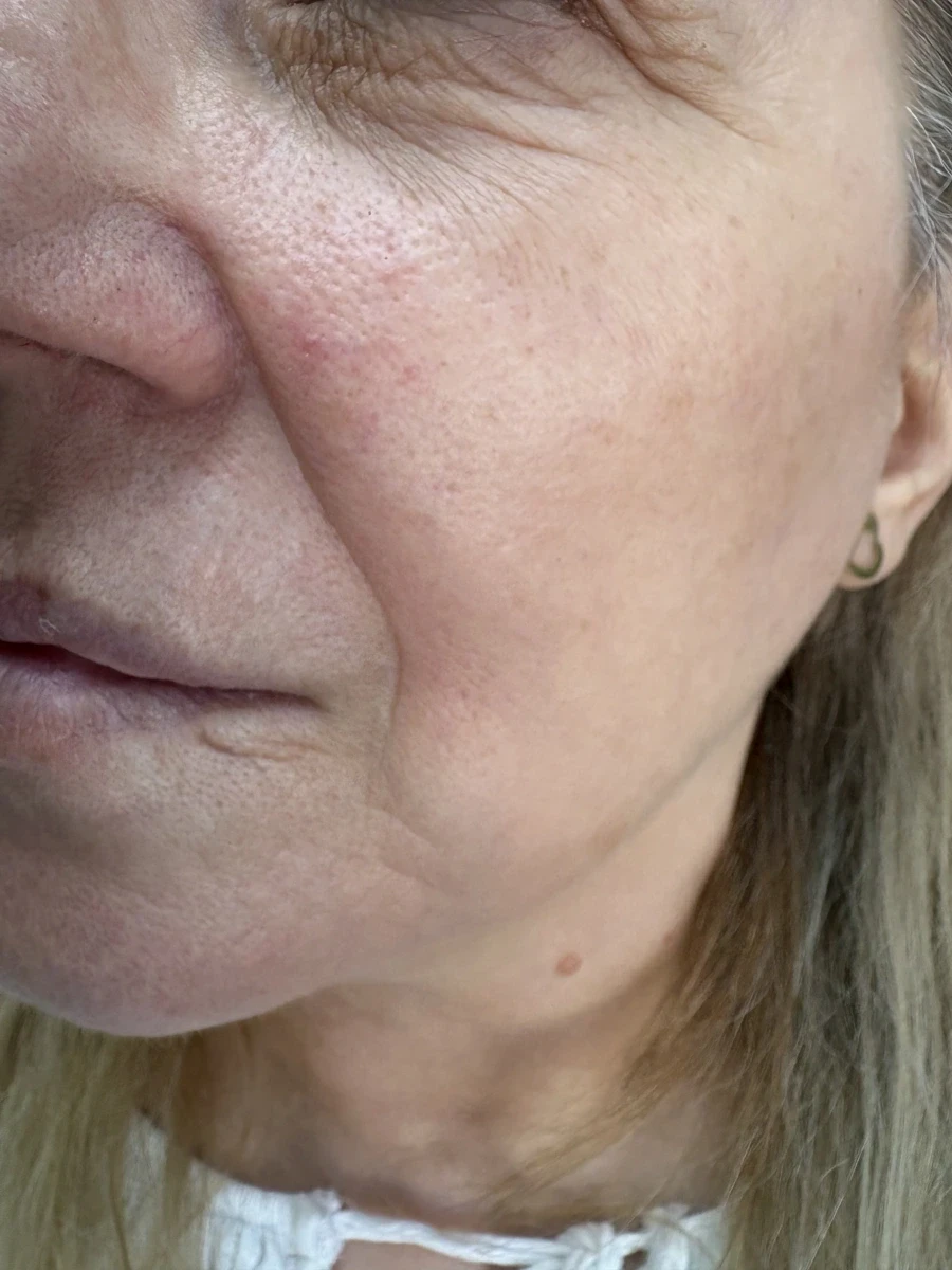 поставяне на филър - Reservation.Studio