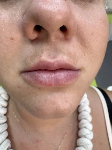 поставяне на филър поставяне на филър