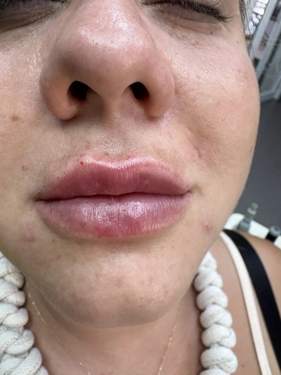 поставяне на филър - Reservation.Studio поставяне на филър - Reservation.Studio