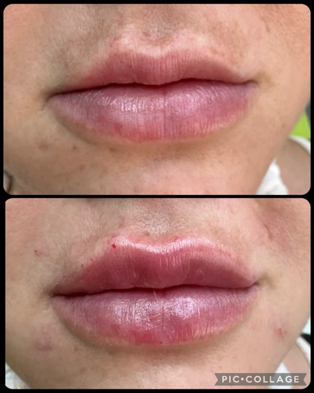 поставяне на филър - Reservation.Studio поставяне на филър - Reservation.Studio