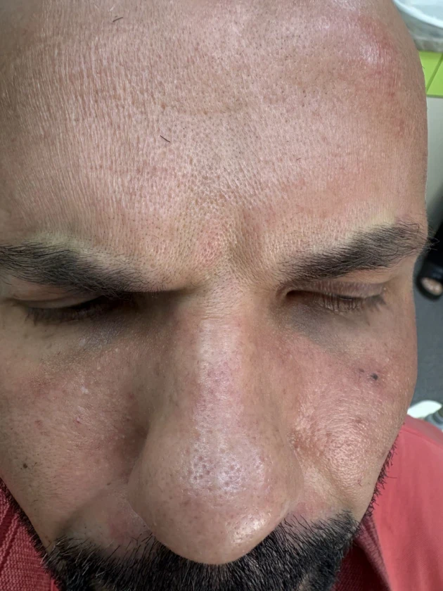 поставяне на ботокс - Reservation.Studio