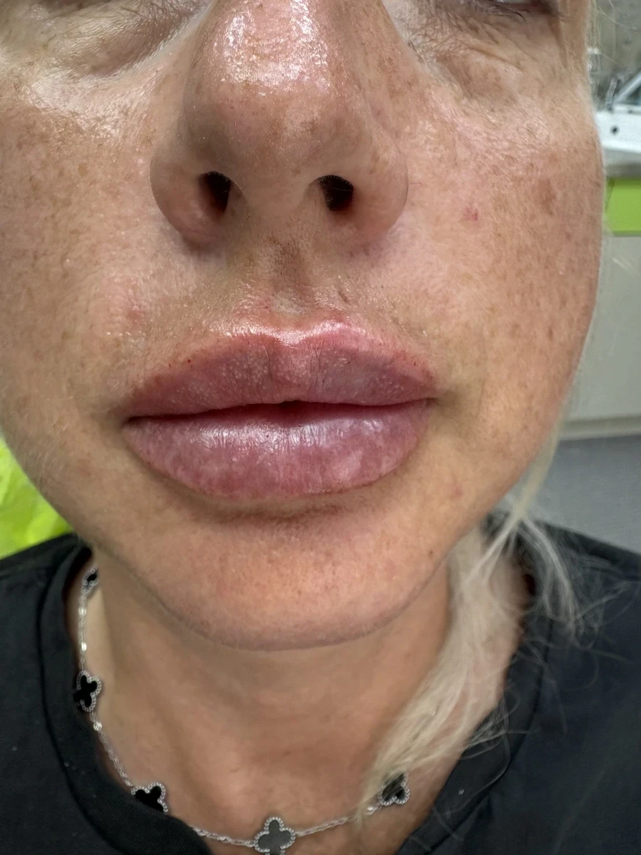 поставяне на филър - Reservation.Studio поставяне на филър - Reservation.Studio