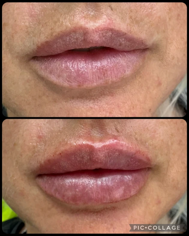 поставяне на филър - Reservation.Studio