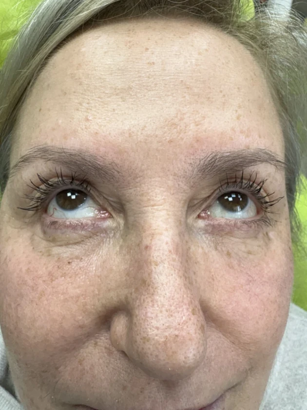 Поставяне на колагеностимулиращ филър/HArmoniCA,Ellanse,Juvelook,Lenisna - Reservation.Studio Поставяне на колагеностимулиращ филър/HArmoniCA,Ellanse,Juvelook,Lenisna - Reservation.Studio