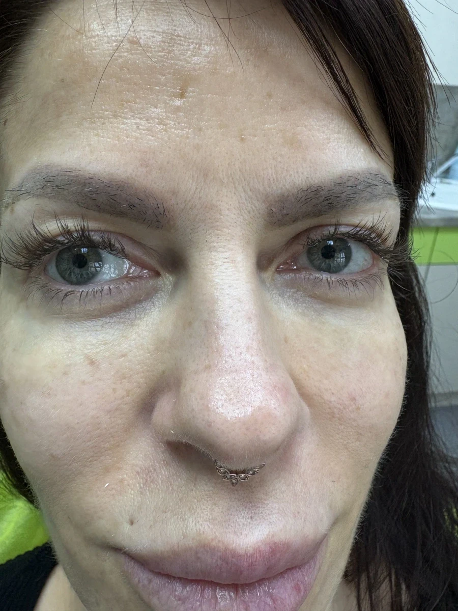 Поставяне на колагеностимулиращ филър/HArmoniCA,Ellanse,Juvelook,Lenisna - Reservation.Studio Поставяне на колагеностимулиращ филър/HArmoniCA,Ellanse,Juvelook,Lenisna - Reservation.Studio