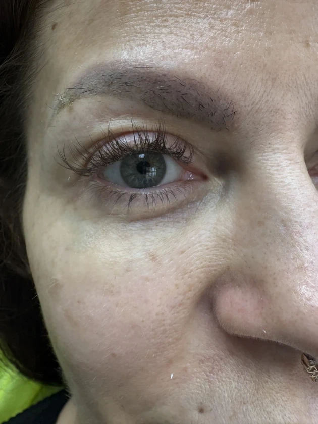 Поставяне на колагеностимулиращ филър/HArmoniCA,Ellanse,Juvelook,Lenisna - Reservation.Studio Поставяне на колагеностимулиращ филър/HArmoniCA,Ellanse,Juvelook,Lenisna - Reservation.Studio