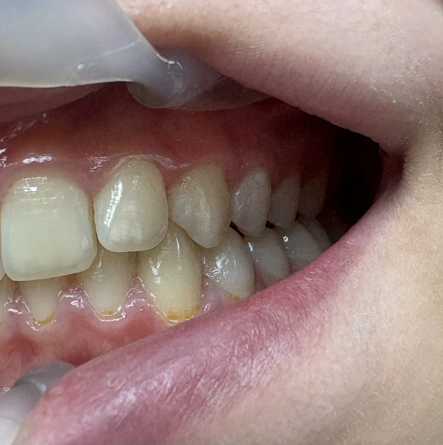 Стрипинг - Reservation.Studio Стрипинг - Reservation.Studio