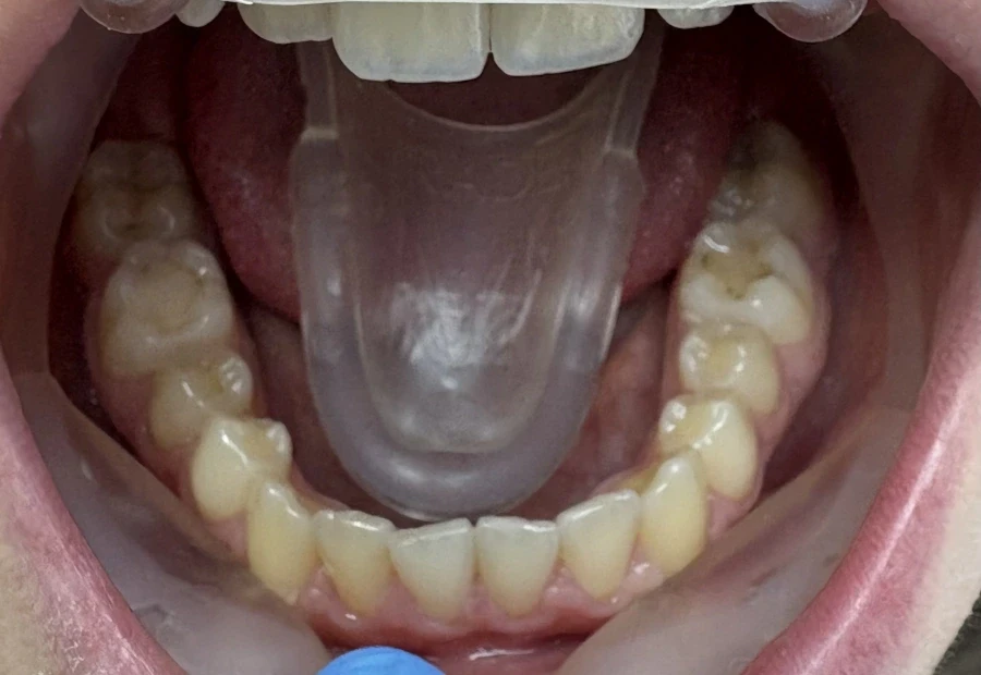 Стрипинг - Reservation.Studio Стрипинг - Reservation.Studio