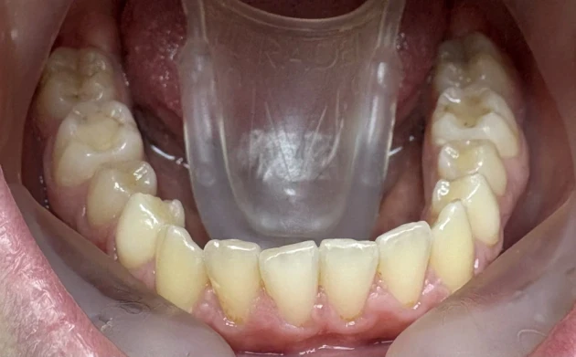 Стрипинг - Reservation.Studio Стрипинг - Reservation.Studio