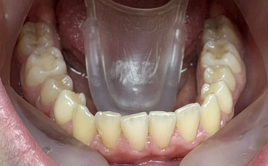 Стрипинг - Reservation.Studio