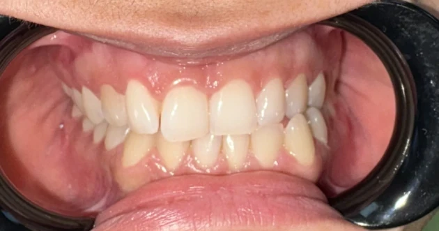 отпечатък за алайнери - Reservation.Studio отпечатък за алайнери - Reservation.Studio