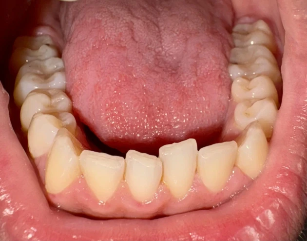 отпечатък за алайнери - Reservation.Studio