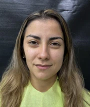 отпечатък за алайнери