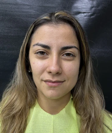 отпечатък за алайнери отпечатък за алайнери