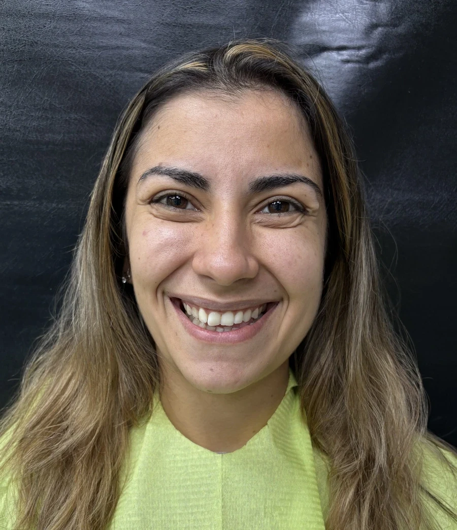 отпечатък за алайнери - Reservation.Studio