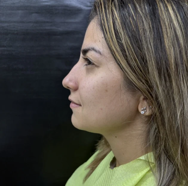 отпечатък за алайнери - Reservation.Studio