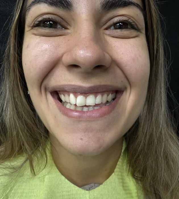 отпечатък за алайнери - Reservation.Studio отпечатък за алайнери - Reservation.Studio