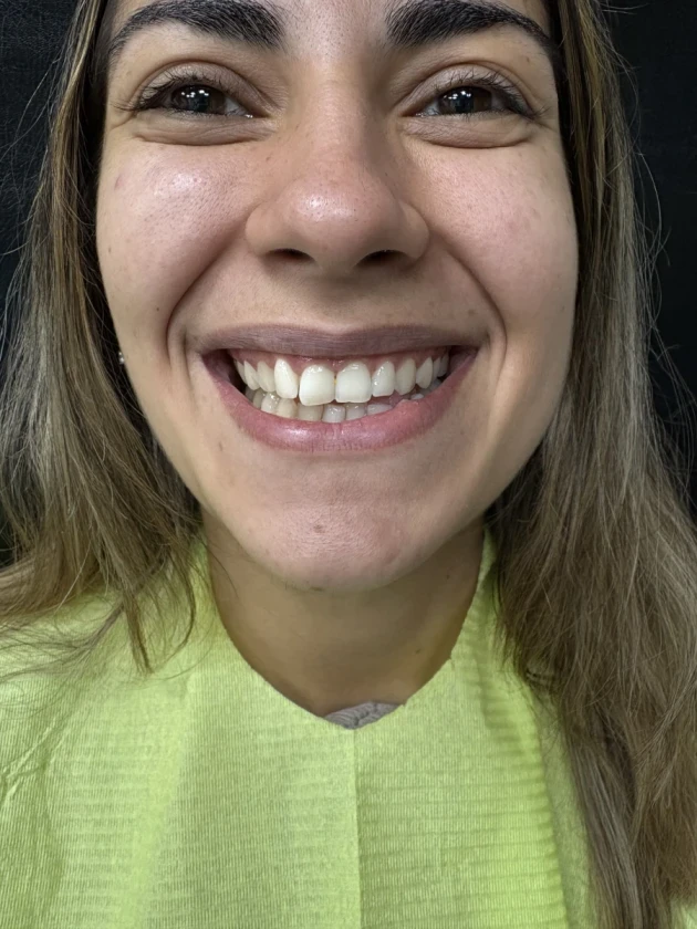 отпечатък за алайнери - Reservation.Studio