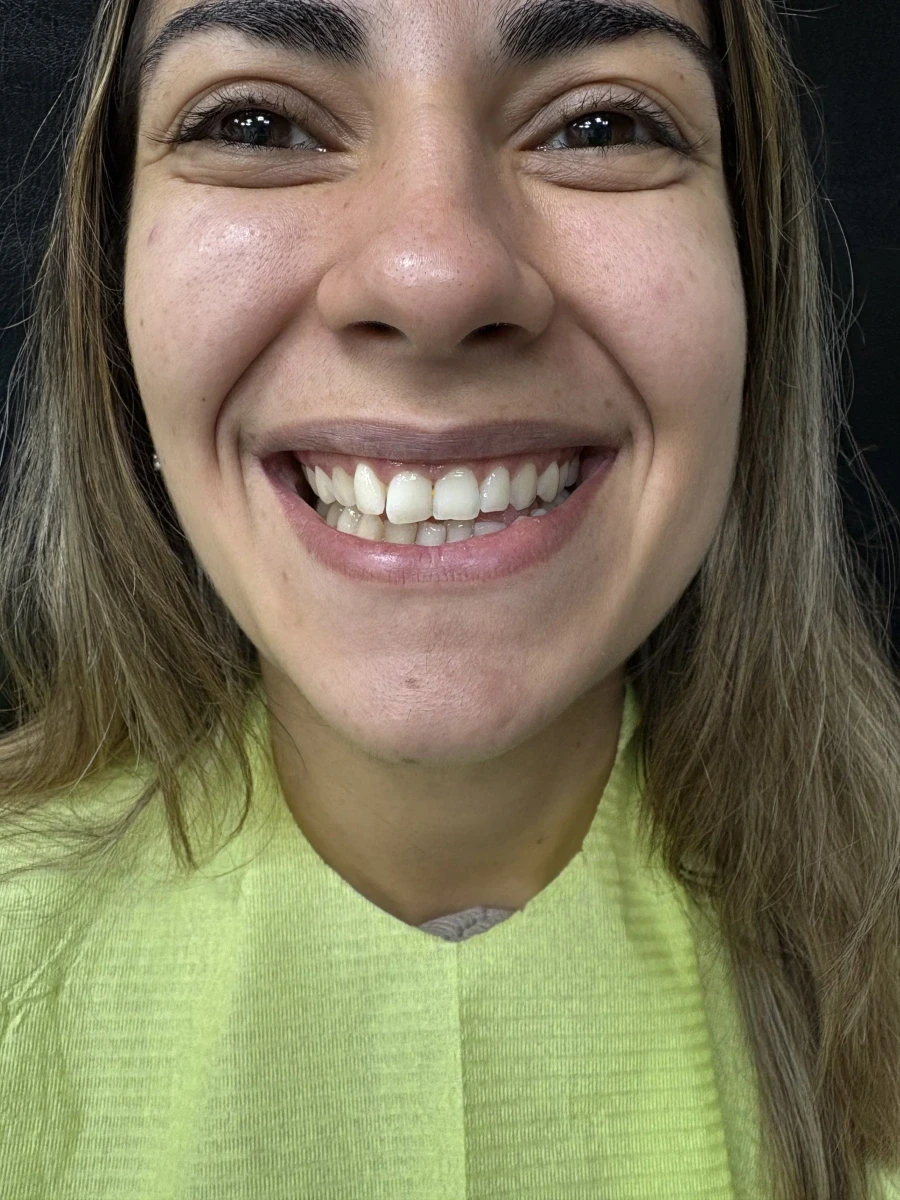 отпечатък за алайнери - Reservation.Studio